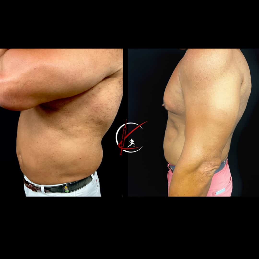 Client transformation 3